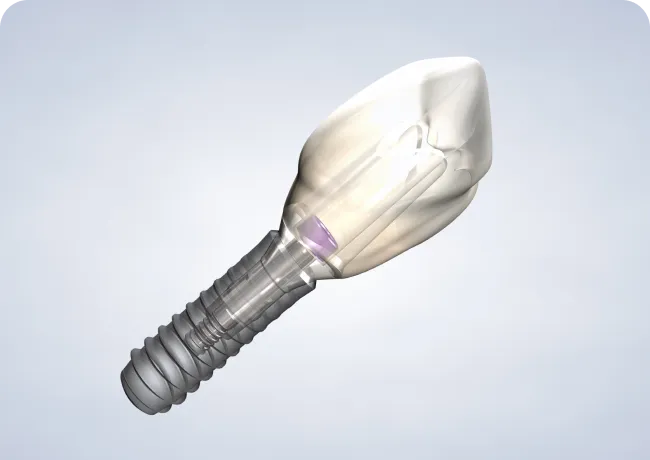 Home  dental implants