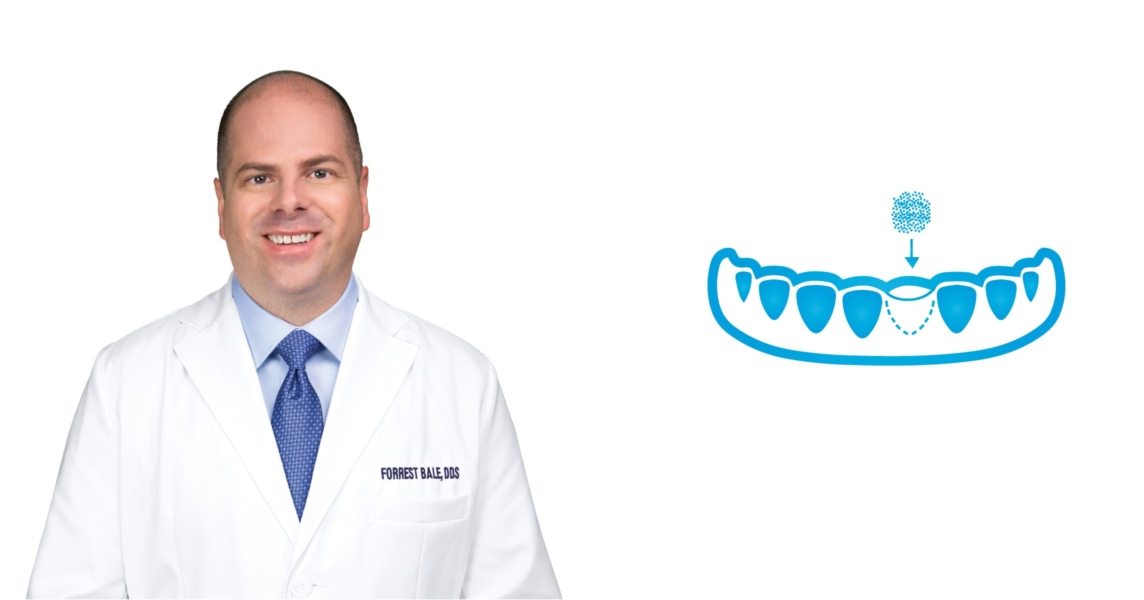 Bone Grafting in Russellville, AR